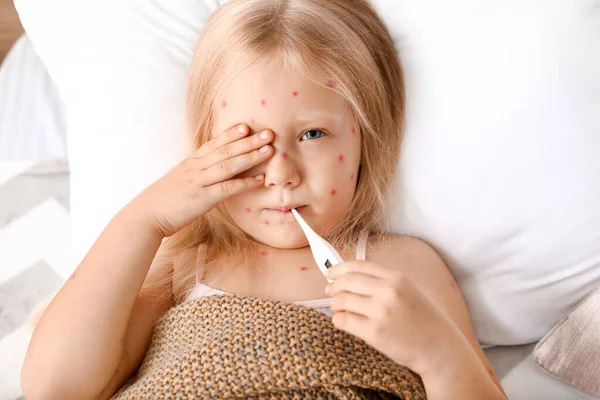 Niña enferma con varicela acostada en la cama — Foto de Stock