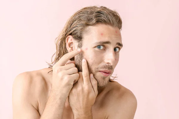 Portret van een jonge man met acne probleem squishing puistjes op kleur achtergrond — Stockfoto