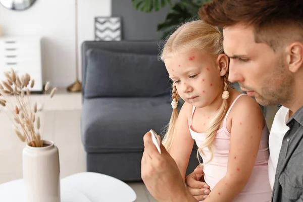 Man measuring temperature of his little daughter ill with chickenpox at home — Stock Photo, Image