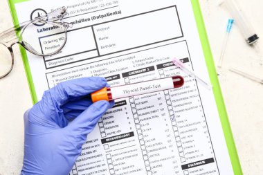 Doktorun eli, tüp içinde kan örneği ve laboratuvar test formu, üst görüş. Tiroit hastalığı kavramı