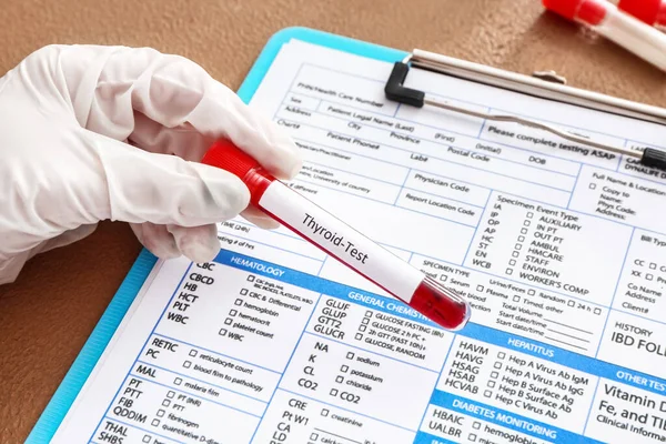 Mano Del Médico Con Muestra Sangre Forma Tubo Prueba Laboratorio — Foto de Stock