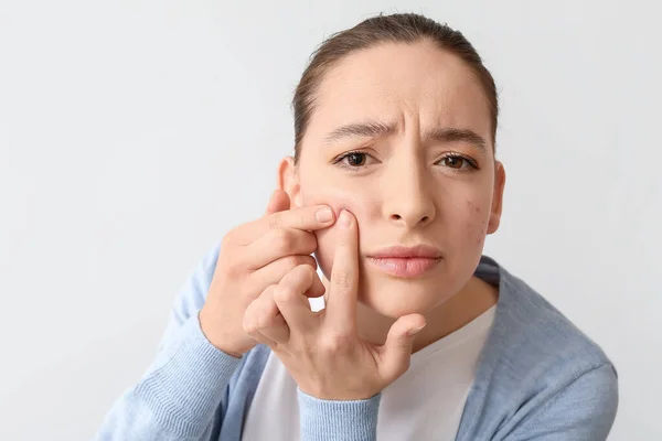 Retrato Mujer Joven Con Problemas Acné Aplastamiento Espinillas Sobre Fondo — Foto de Stock