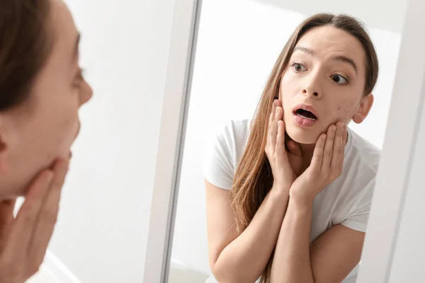 Retrato Mujer Joven Con Problemas Acné Mirando Espejo — Foto de Stock