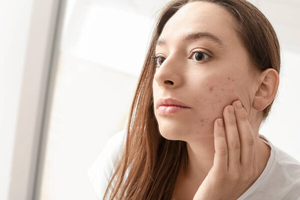 Portrait of young woman with acne problem looking in mirror