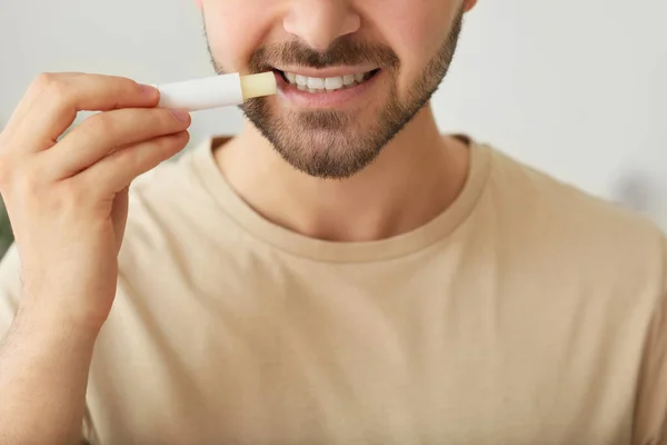 Schöner Junger Mann Mit Lippenbalsam Hause Nahaufnahme — Stockfoto