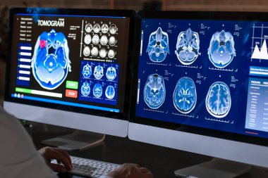 İnsan kafasının MRI taramasına sahip erkek nörolog klinikteki bilgisayar monitöründe