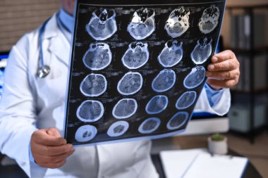 İnsan beyninin MRI taramasıyla klinikte kıdemli nörolog.