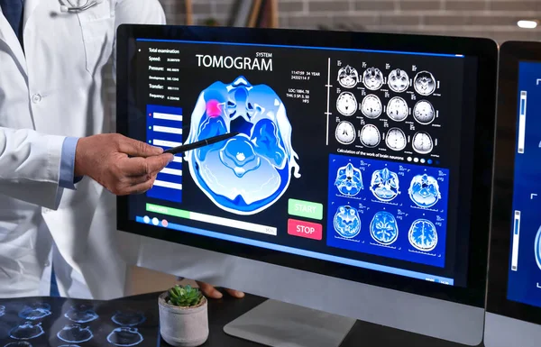 Neurologista Sênior Com Ressonância Magnética Cabeça Humana Tela Monitor Computador — Fotografia de Stock