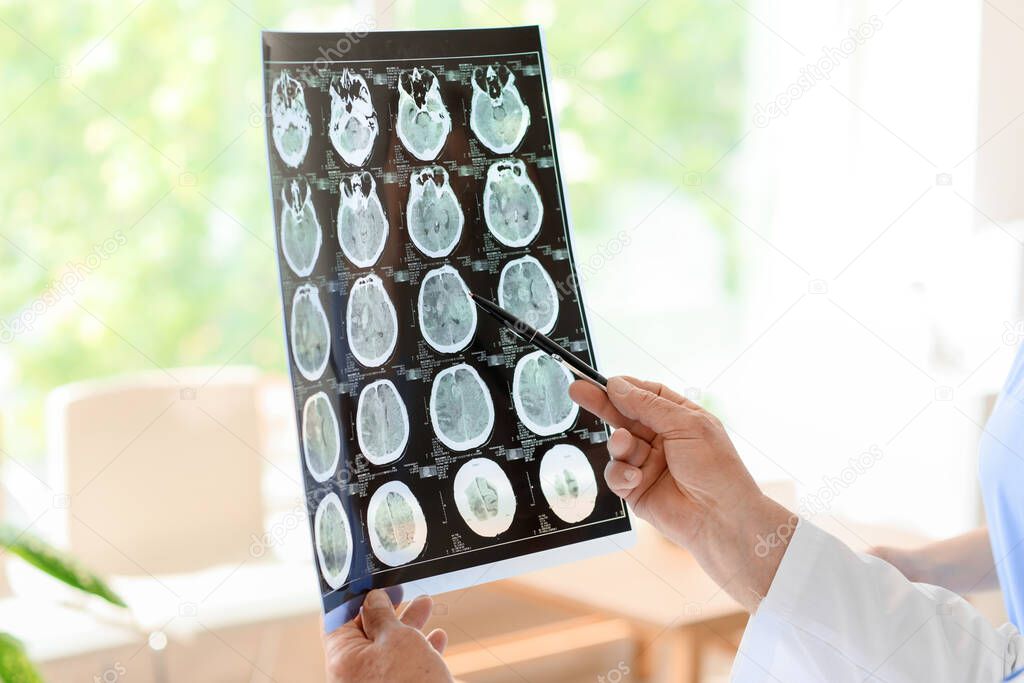 Senior neurologist with MRI scan of human head in clinic