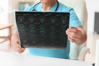 İnsan beyninin MRI taramasıyla klinikte kıdemli nörolog.