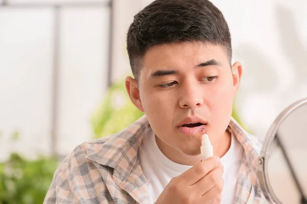 Asian Man Cold Sore Applying Ointment His Lips — Stock Photo, Image