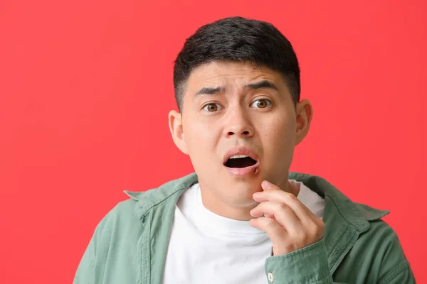 Asian man with cold sore on color background