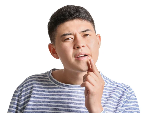 Asian Man Cold Sore Applying Ointment His Lips White Background — Stock Photo, Image