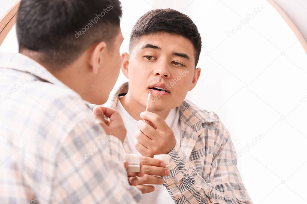 Asian man with cold sore applying ointment on his lips near mirror