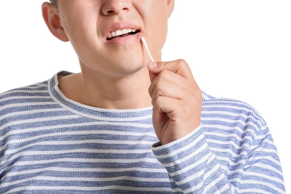 Asian Man Cold Sore Applying Ointment His Lips White Background — Stock Photo, Image