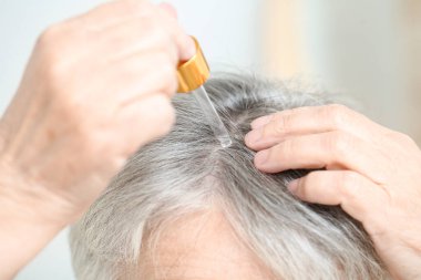 Saç dökülmesi tedavisi için serum kullanan yaşlı kadın, yakın plan.