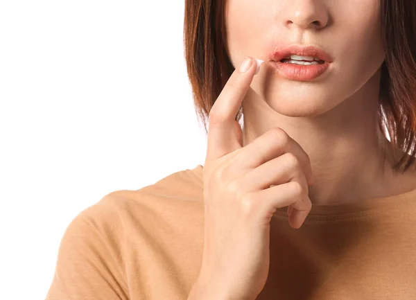 Young Woman Cold Sore Applying Ointment Her Lips White Background — Stock Photo, Image