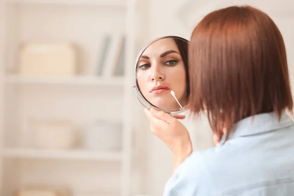 Young woman with cold sore applying remedy at home