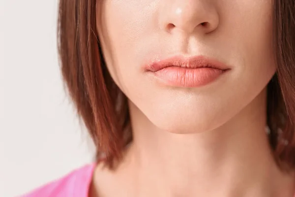 Young woman with cold sore on light background, closeup