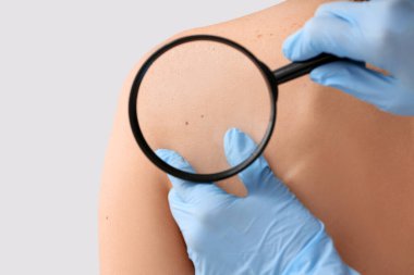 Dermatolog, hafif arka plandaki hastayı muayene ediyor. Yakın plan.