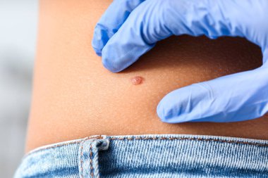Dermatolog klinikteki hastayı muayene ediyor.