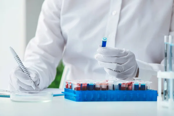 Scientist Working Blood Samples Laboratory — Stock Photo, Image