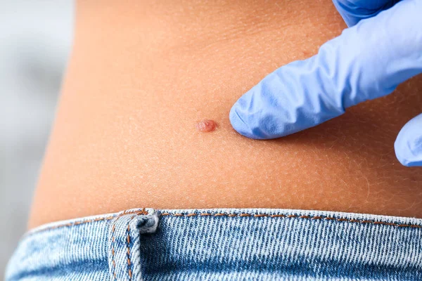 Dermatologista Examinando Paciente Clínica Close — Fotografia de Stock