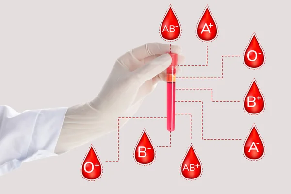 Tube Sample Doctor Hand Light Background Determination Blood Groups — Stock Photo, Image