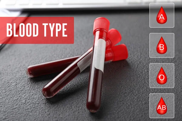 Tubos Ensaio Com Amostras Mesa Determinação Dos Tipos Sanguíneos — Fotografia de Stock