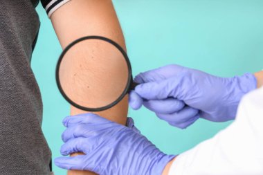 Dermatolog hastayı renk geçmişi ve yakın plan incelemesi yapıyor.