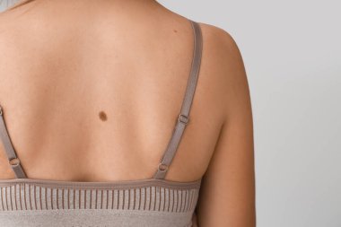 Işıklı arka planda benleri olan kadın