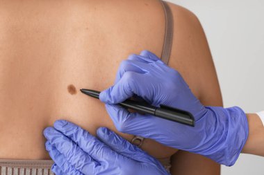 Dermatolog klinikteki hastayı muayene ediyor.