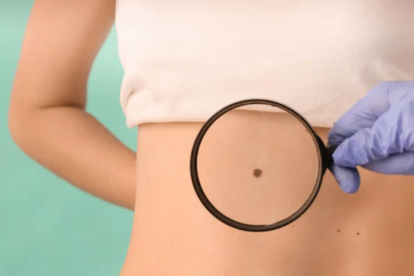 Dermatologist Examining Patient Color Background Closeup — Stock Photo, Image