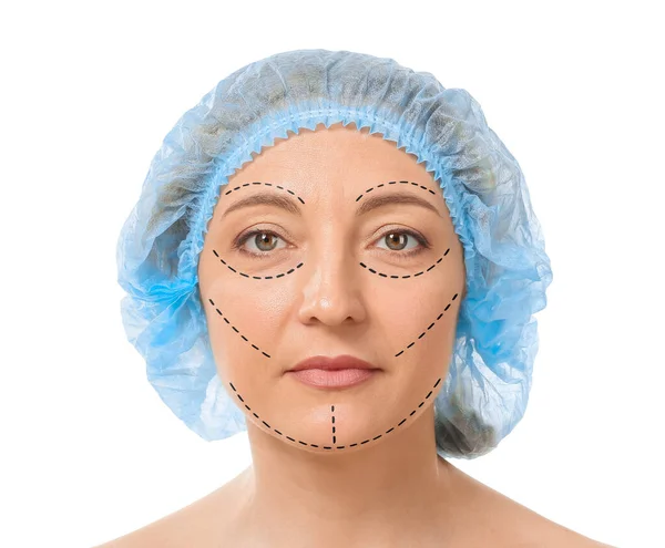 Mujer Madura Con Marcas Cara Sobre Fondo Blanco Concepto Cirugía — Foto de Stock