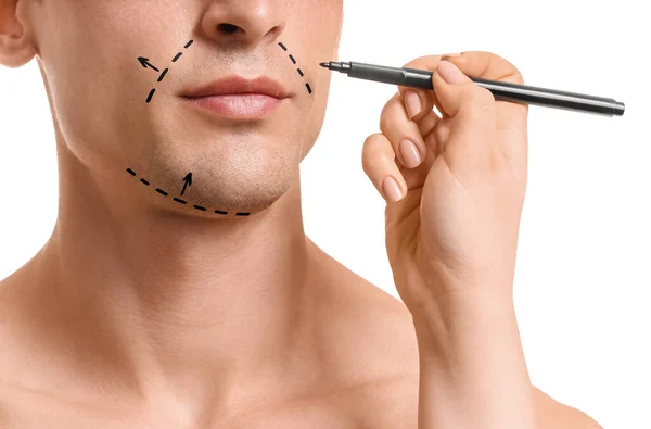 Plastic Surgeon Applying Marking Man Face White Background — Stock Photo, Image