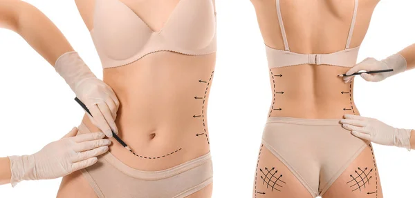 白い背景に女性の体にマークを適用する形成外科医 — ストック写真