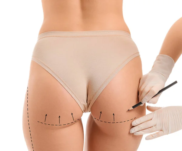 Plastic Surgeon Applying Marks Woman Body White Background — Stock Photo, Image