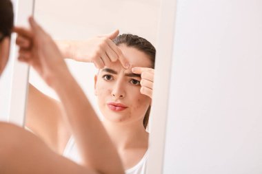 Sivilceli genç bir kadın aynanın yanında sivilceleri eziyor.