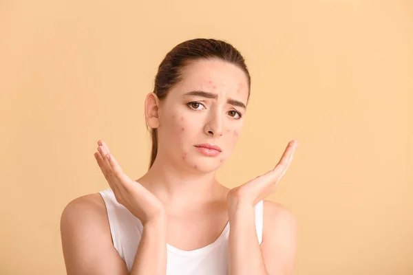 Triste Jeune Femme Avec Problème Acné Sur Fond Couleur — Photo