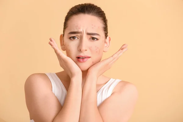 Mujer Joven Triste Con Problemas Acné Fondo Color — Foto de Stock