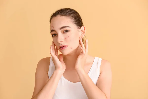 Mujer Joven Con Problemas Acné Fondo Color — Foto de Stock