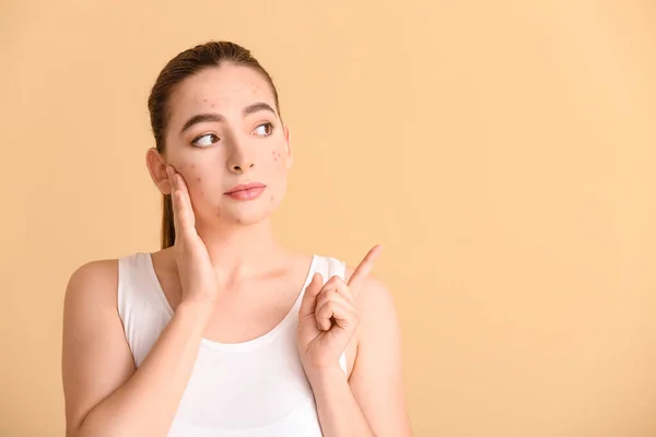 Mujer Joven Con Problemas Acné Fondo Color — Foto de Stock