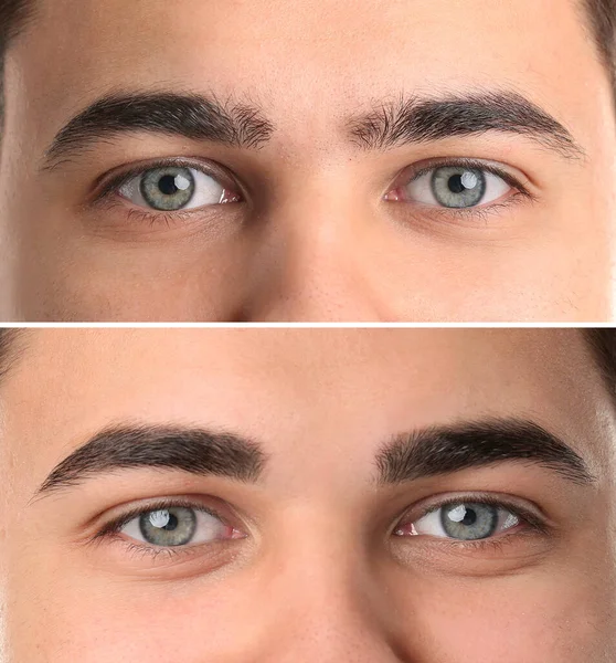Young Man Eyebrows Correction Closeup — Stock Photo, Image