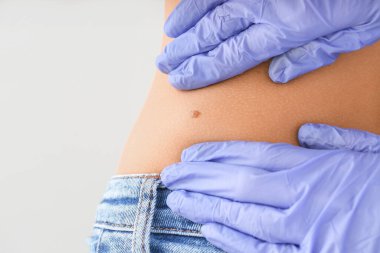 Dermatolog, hafif arka plandaki hastayı muayene ediyor. Yakın plan.