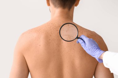 Dermatolog, hafif arka plandaki hastayı inceliyor.