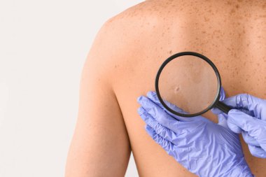 Dermatolog, hafif arka plandaki hastayı inceliyor.
