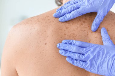 Dermatolog klinikteki hastayı muayene ediyor.