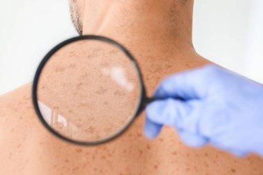 Dermatolog klinikteki hastayı muayene ediyor.
