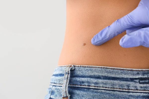 Dermatologist Examining Patient Light Background Closeup — Stock Photo, Image