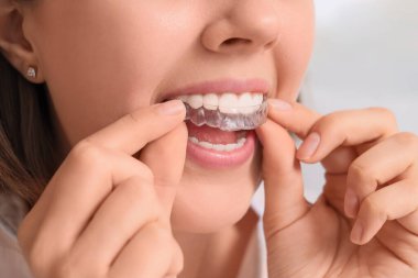 Young woman putting occlusal splint in mouth at home, closeup